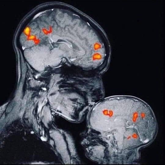 The world's first magnetic resonance image of a mother kissing her baby